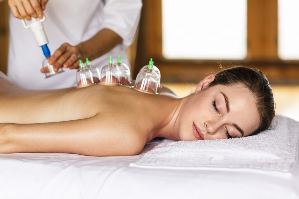 Cupping Therapy Faq It S More Than Just Trendy Spots Revive Massage